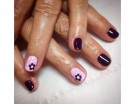 Anulari rosa e neri